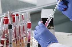 Найбільша кількість випадків захворювання зареєстрована у Харківській області та місті Києві