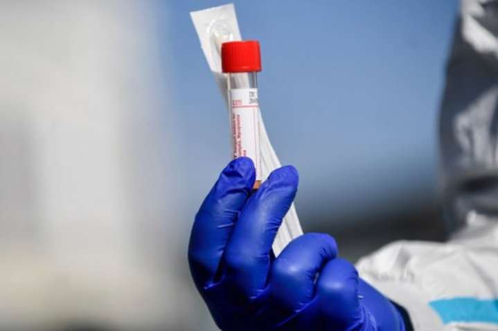 В Україні ввели в обіг новий тест на коронавірус: подробиці