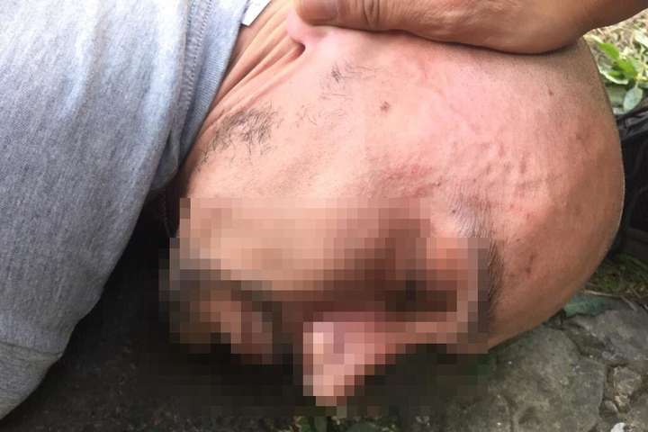 Вбивство фармацевта в Одесі: з'явилося фото затриманого
