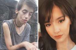 Невероятные трансформации людей, поборовших наркотическую зависимость (фото)