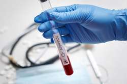 Київ і чотири області в лідерах за добовим приростом хворих на коронавірус