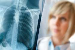 Цього року тариф на лікування одного хворого на туберкульоз складав 20 663 гривні