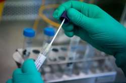 Кожному пацієнту, який має симптоми захворювання на коронавірус, в комунальних медзакладах столиці тести роблять безкоштовно