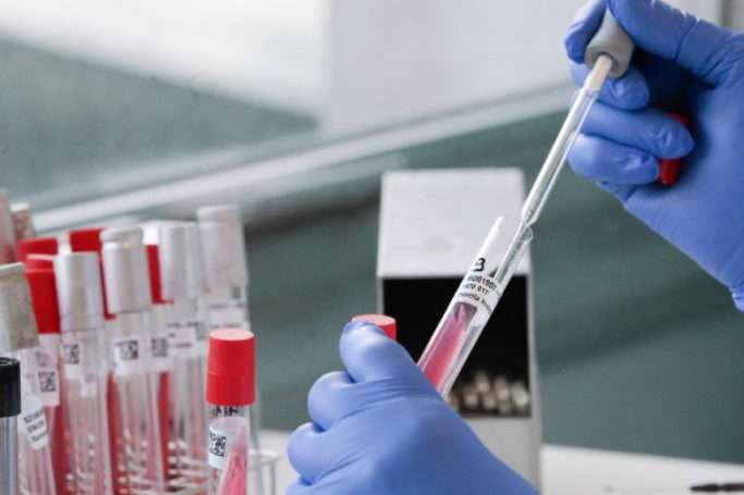 В Одесі лабораторія припинила робити ПЛР-тести через інфікування персоналу