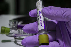 Спалах коронавірусу. Клуб італійської Серії А повідомив про 14 інфікованих людей  