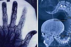 Когда рентгеновские снимки показали людям тайны, которые были скрыты от их глаз