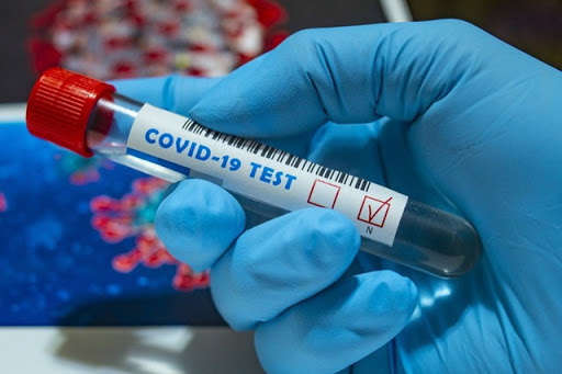 У світі на сьогодні коронавірусом заразилися майже, 34,5 млн людей