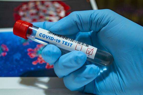 У світі вже зафіксовано майже 36,5 людей, які заразилися коронавірусом