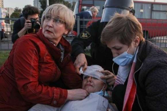 Чехія прийняла на лікування десятки постраждалих білоруських мітингувальників