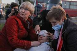 Чехія прийняла на лікування десятки постраждалих білоруських мітингувальників