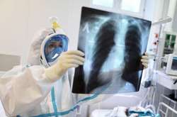  За минулу добу від коронавірусу померли 107 осіб 