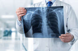 ООН: боротьба з туберкульозом опинилася під загрозою через пандемію Covid-19