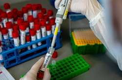 У світі коронавірусом заразилися вже понад 38, 8 млн людей