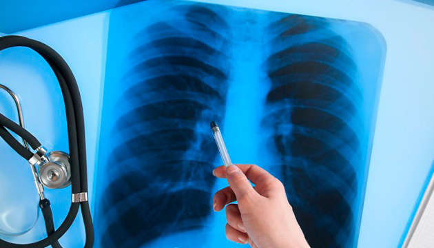 ООН: борьба с туберкулезом оказалась под угрозой из-за пандемии Covid-19