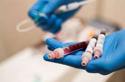 Вартість однієї порції плазми становила $100-200