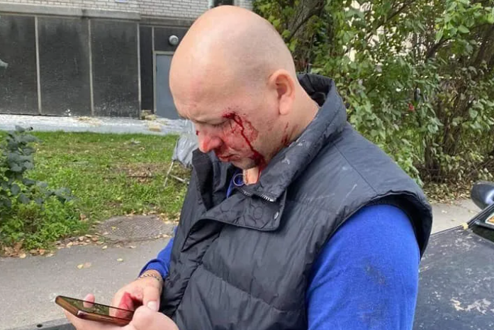 У Києві побили ветерана АТО та його дружину