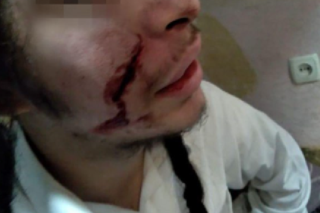 В Умані невідомі нанесли ножове поранення 17-річному брацлавському хасиду (відео)