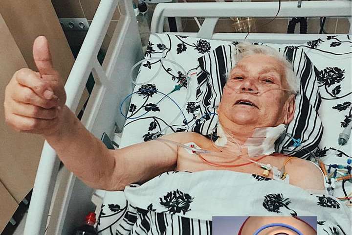 Львівські медики прооперували серце 80-річної пацієнтки без жодного розрізу