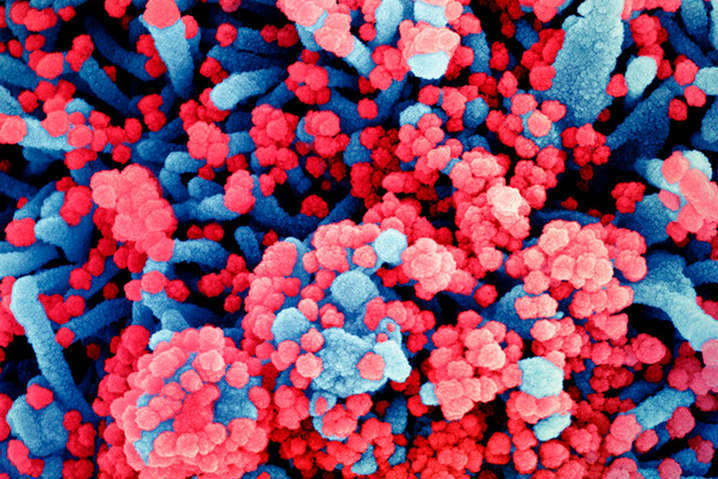 Ученые нашли уязвимое место у коронавирусов