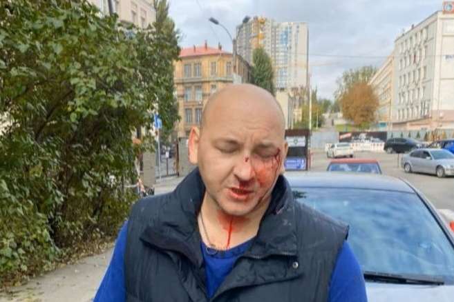 В Киеве миллионер, отсидевший за убийство, жестоко избил инвалида войны на Донбассе