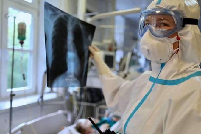 Коронавірус у світі: найбільше нових хворих виявили в США, Україна на 16-му місці