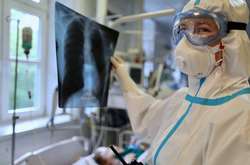 Всього в світі Covid-19 захворіли 42489901 осіб