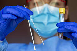 Надо ли делать ПЦР-тест? Ляшко рассказал о новых требованиях для госпитализации больных