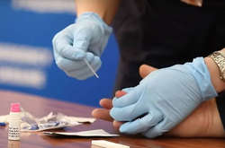  МОЗ планує закупити тести, які використовують експрес-метод визначення на антиген