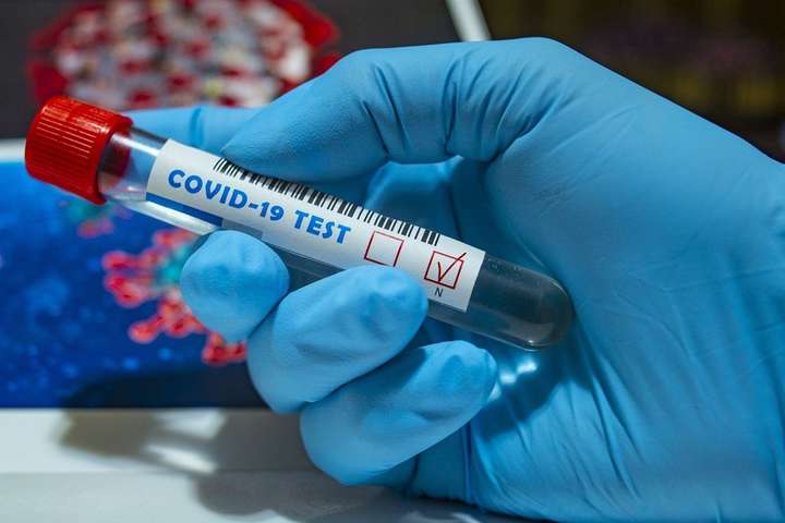 У Росії новий антирекорд смертей від коронавірусу
