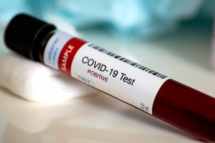 МОЗ планує витратити майже 2 млрд грн на новий метод діагностики Covid-19