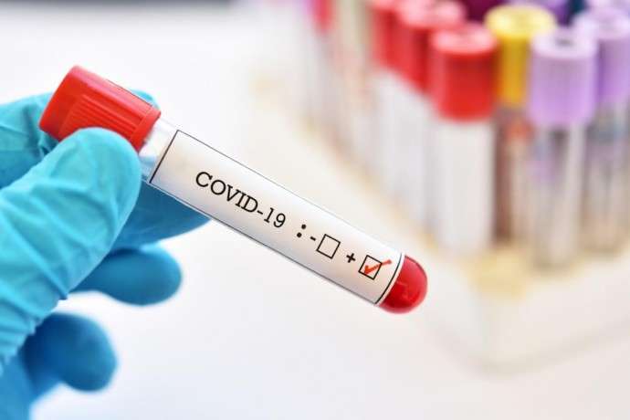 На Вінниччині підтверджено 11644 випадків коронавірусу