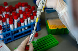 Кількість померлих від коронавірусу у світі зросла до 1 241 878 людей