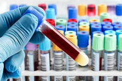 Найбільше хворих зареєстрували у Москві 