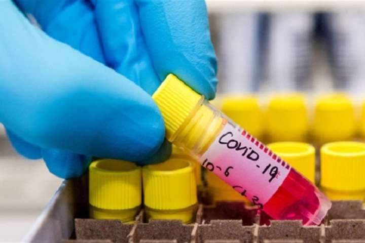 У Полтаві анулювали результати 1,5 тис. тестів на коронавірус