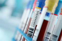 У світі на Covid-19 вже захворіло понад 51 млн людей