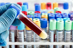 У США в даний час зафіксовано 11066546 випадків