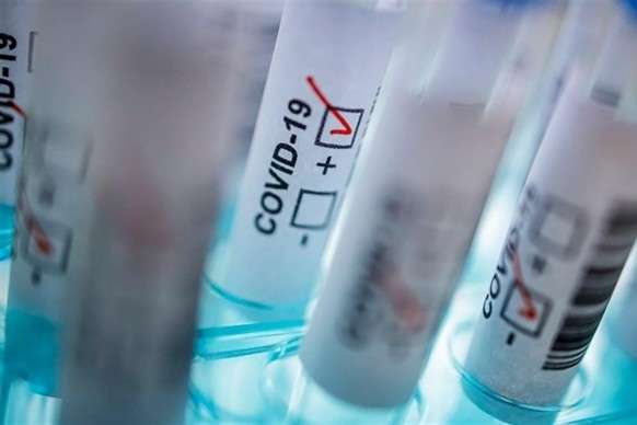 На Вінниччині підтвердили 14532 випадків коронавірусу