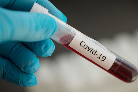 В українській армії за добу зафіксували 225 нових випадків коронавірусу