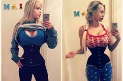 В Швеции девушка удалила себе шесть ребер ради осиной талии (фото)