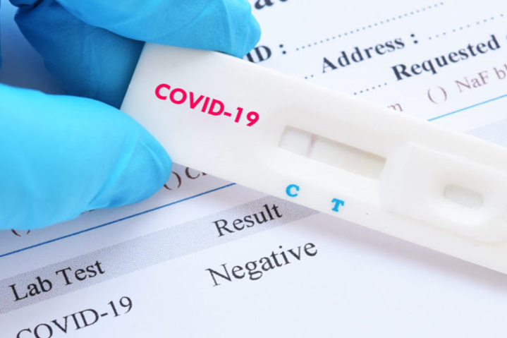 Чехія планує ввести безкоштовне тестування населення на Covid-антиген 