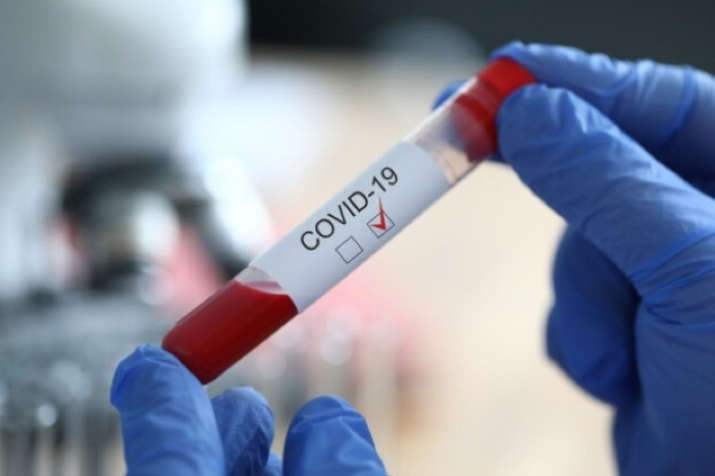 У світі коронавірус виявили вже у понад 61,3 млн людей