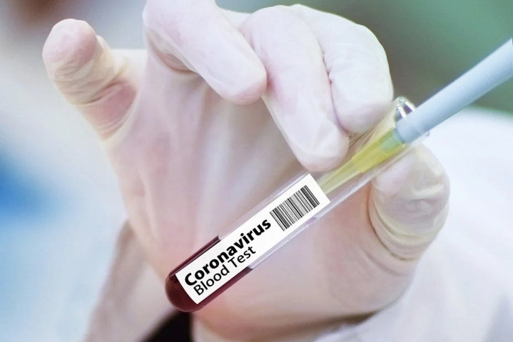 Країни Африки не готові до вакцинації населення від Covid-19, – ВООЗ