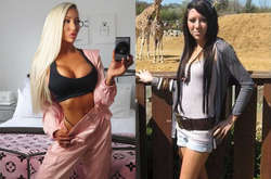 Чарли Филлипс сейчас и до операций