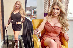 Британку с редкой болезнью ошибочно отправили в психушку. Она вылечилась и стала моделью (фото)