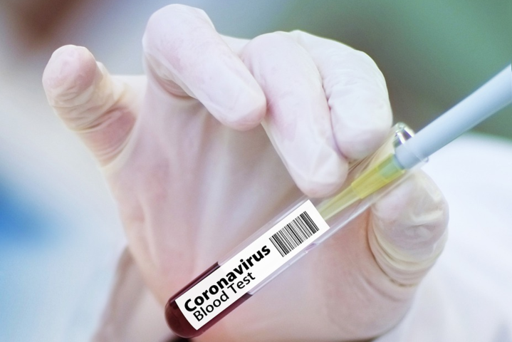 Чехія припинила розробку вакцини від коронавірусу