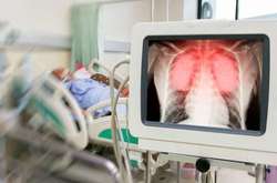 У Львові лікарі борються за життя вагітної, у якої коронавірус вразив 90% легень