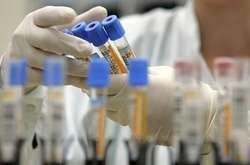 У світі коронавірус виявили у понад 72,7 млн людей