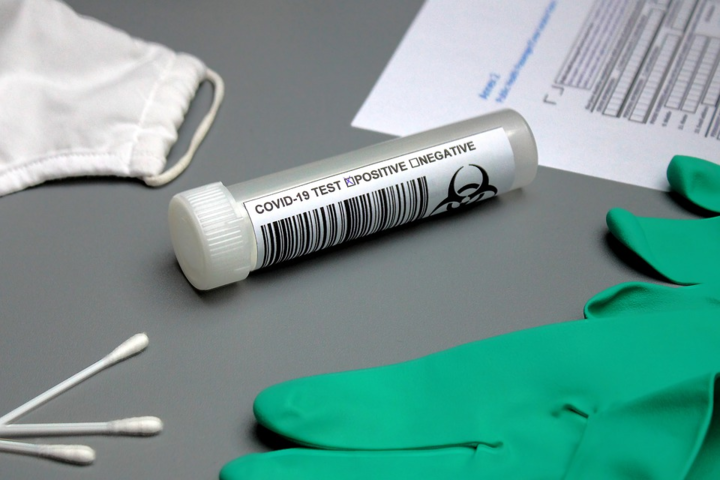 Франція розпочала масове тестування населення на коронавірус