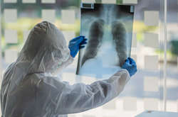 Що таке постковідний синдром: які симптоми та як його лікувати