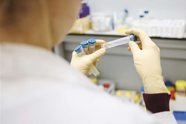 МОЗ відповів, чи можуть в Україні діагностувати нові штами коронавірусу